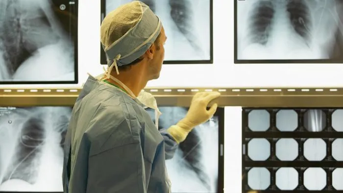 Roadmap to mobile lung cancer screening 